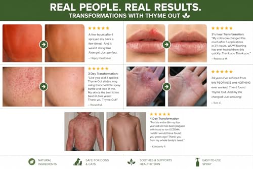 Thyme Out Natural Skin Relief Spray for Eczema, Acne & Irritation