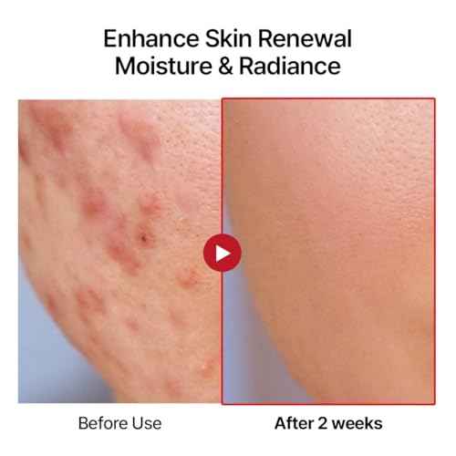 Swanicoco PDRN Hydrating Repair Ampoule Serum Powerful Anti Aging Face and Neck for Skin Turnover Skin Regeneration Wound Healing Korean Skincare, Stocking Stuffer 30ml 1Fl Oz