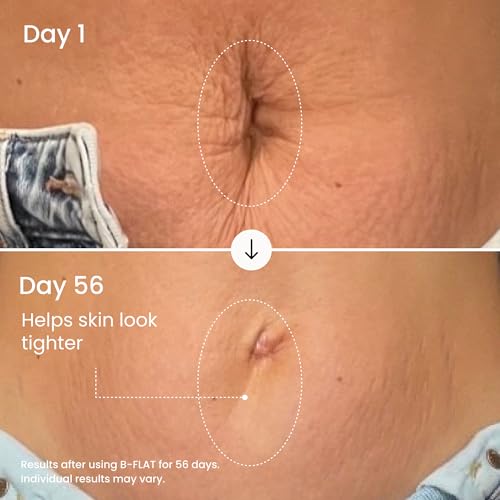 MA?LYS B-FLAT Belly Firming Cream for Women - Skin Tightening & Moisturizing Treatment with Shea Butter & Bentonite Clay - Smooths Look of Stretch Marks - Postpartum Body Care (3.4 Fl Oz)