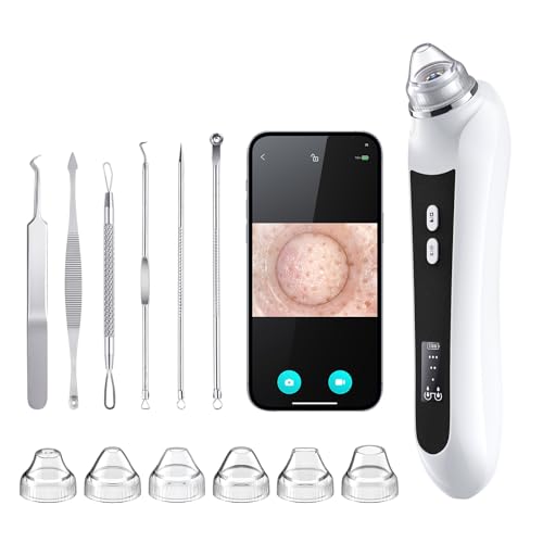 Ottleba HD Camera Blackhead Remover with 3 Suction Modes