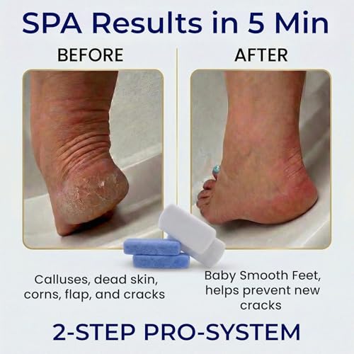Earth & I Pumice Stone for Feet - Siliglass Foot Callus Remover (6-Pack)