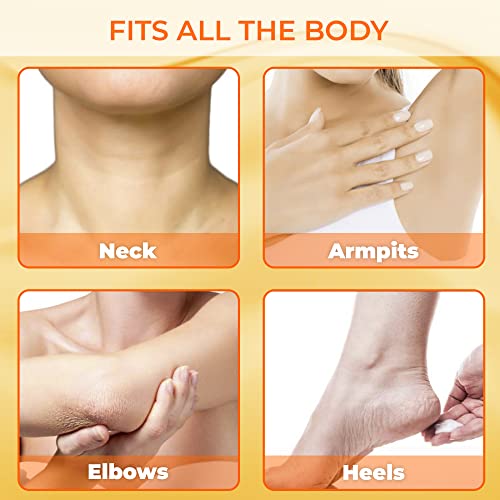 CAROT?S Brightening Gel | 30g / 1 fl oz | Fade Dark Spots on: Face Armpit, Body Knees, Feet, Hands, & Even Out Skin Tone | with Carrot Oil and Alpha Arbutin, For