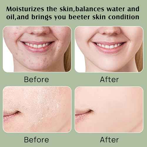 Beef Tallow Moisturizer,Beef Tallow for Skin,Organic Grass Fed Beef Tallow with Raw Honey Moisturizing Cream, Whole Body & Face Moisturizer£¨4oz£©