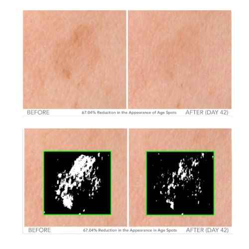 Serious Skincare - Beyond Intensive Vitamin C Serum for Face - 60 Day Facial Treatment for Healthy Glowing Skin and Brightening - Smoothes Lines, Pores and Fades Dark Spots - 2 Piece Anti-Aging Set