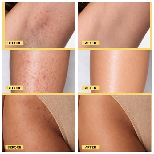 Ingrown Hair Treatment Pads with AHA+BHA - 42 Daily AfterShave Pads