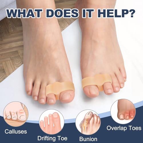 Promifun Beige Gel Toe Corrector 10-Pack for Bunion & Overlapping Toe Relief