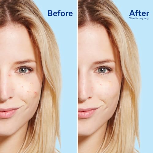 Differin Acne Face Wash with 5% Benzoyl Peroxide - 4oz Daily Cleanser (Pack of 1)