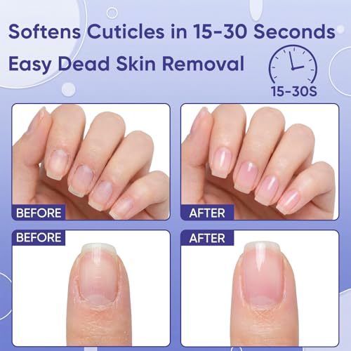 Cuticle Remover Gel Kit - At-Home Manicure Set with Ceramic Pusher Pen