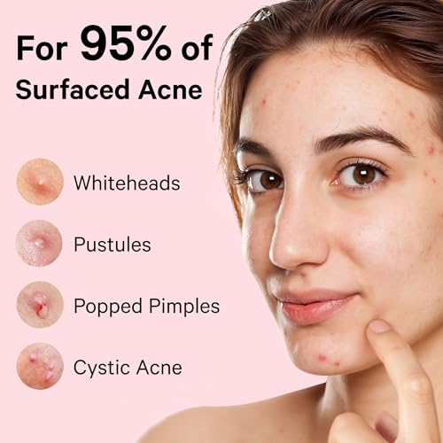 Sosky Hydrocolloid Pimple Patches with Salicylic Acid - 30 Count