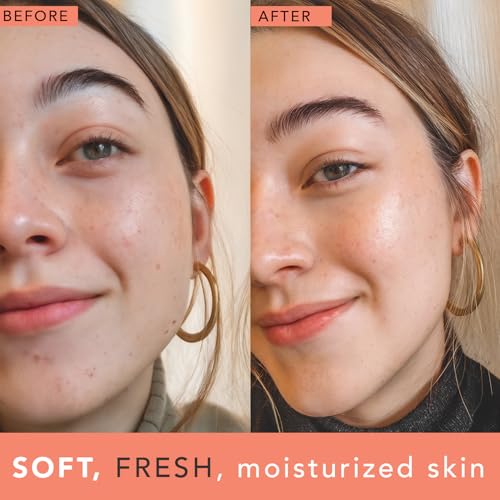 Rose Water Spray for Face - USA Made with Hydrating Natural & Organic Ingredients for Glowing Skin, Alcohol-Free Rosewater Toner Mist with Witch Hazel & Glycerin for Dry and Sensitive Skin