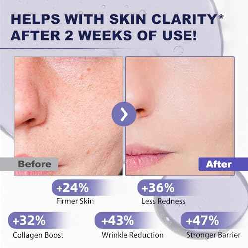 Bakuchiol Retinol Alternative Serum 50ML - 40,000 ppm All Plant-Based Formula Anti-Aging Face & Eye Care Plumping Serum for Sensitive Skin - Natural Firming & Elasticity