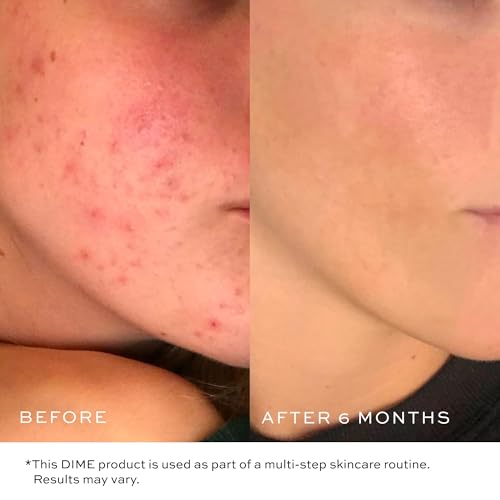 DIME Gentle Jelly Cleanser - Hydrating Gel Face Wash & Makeup Remover