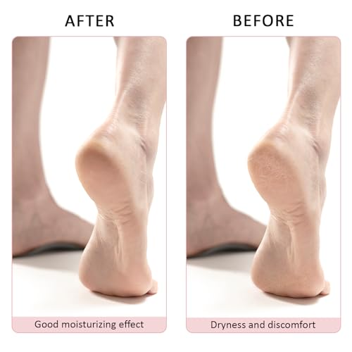 Aloe Infused Fuzzy Moisturizing Socks for Dry Cracked Feet (4 Pairs)