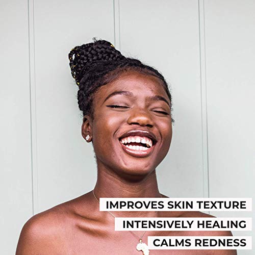 O NATURALS Moisturizing African Black Soap & Detoxifying Charcoal Soap Bar Bundle Two 3 Packs, 4 Ounce Each Bar Of Soap.