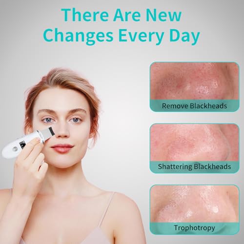 Face Spatula Blackhead Remover - 4 Modes Skin Scrubber