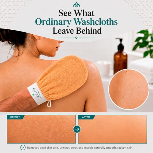 Kessa Exfoliating Glove - Microdermabrasion Mitt for Dead Skin Removal