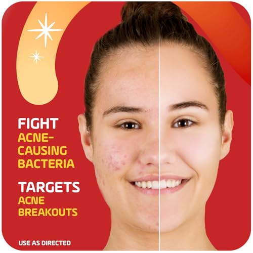 Asepxia 2% Salicylic Acid Acne Spot Treatment Cream, 1 Oz