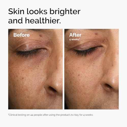 The Ordinary Multi-Antioxidant Radiance Serum, Vitamin C Serum For Face, Brighten & Protect Skin ? Boosts Glow & Shields Against Environmental Stressors, 1 Fl Oz