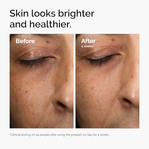 The Ordinary Multi-Antioxidant Radiance Serum, Vitamin C Serum For Face, Brighten & Protect Skin ? Boosts Glow & Shields Against Environmental Stressors, 1 Fl Oz