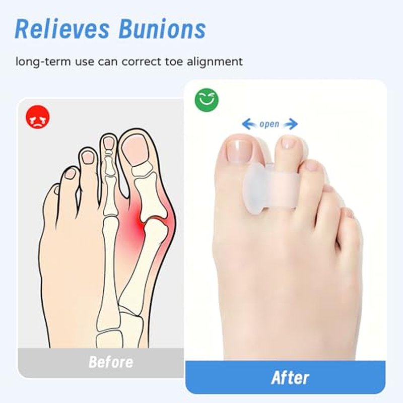 12 Pcs Gel Toe Separators for Women & Men - Comfort Spacers for Bunions