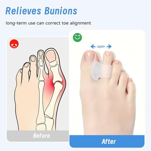 12 Pcs Gel Toe Separators for Women & Men - Comfort Spacers for Bunions