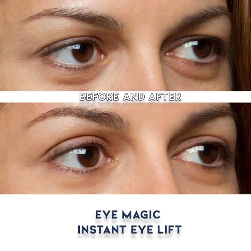 Eye Magic Premium Eye Lift Strips - 80 Count Medium