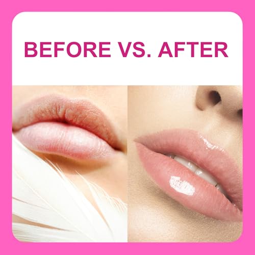 Kirby 6EA Small Lip Balm for Girls, Cute Lip Balm for Women with Camellia, Jojoba Seed Oil& Vitamin E, Shea Butter Lip Balm & Lip Moisturizer for Dry Lips, Made in Japan, Strawberry+Peach+Cake
