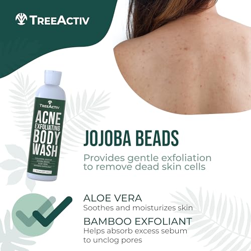 TreeActiv Exfoliating Acne Body Wash 8 fl oz Body Acne Wash for Back, Chest, Shoulder, Back Acne Treatment with Jojoba Beads, Back Acne Body Wash for Bacne, Soothing Body Acne Treatment for Men, Women