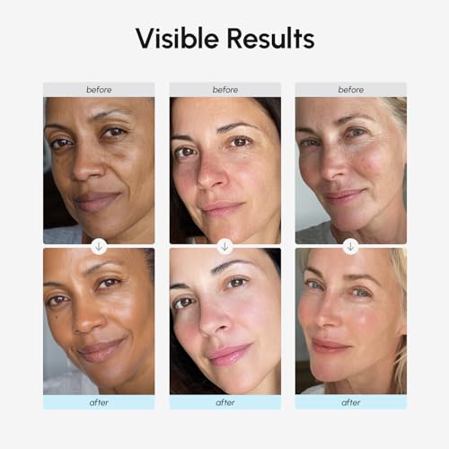 MAREE Eye Gels & Collagen Moisturizer Face Cream Bundle - Under Eye Gels for Puffy Eyes and Dark Circles, Anti Aging Face Cream with Hydrating Effect - Marine Collagen & Hyaluronic Acid, Retinol