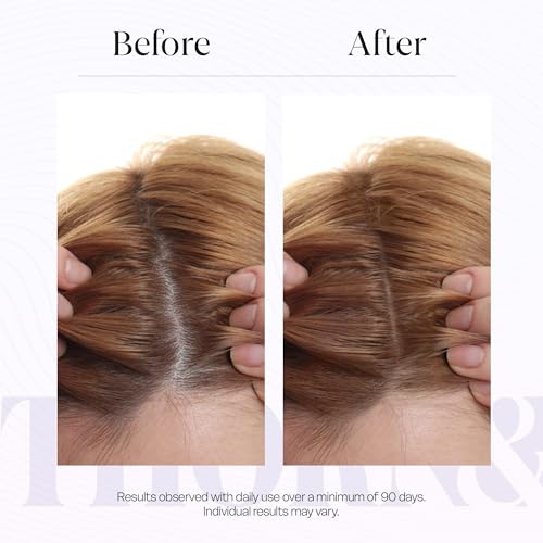 Hair Growth Serum for Thinning Hair - Biotin & Peptides
