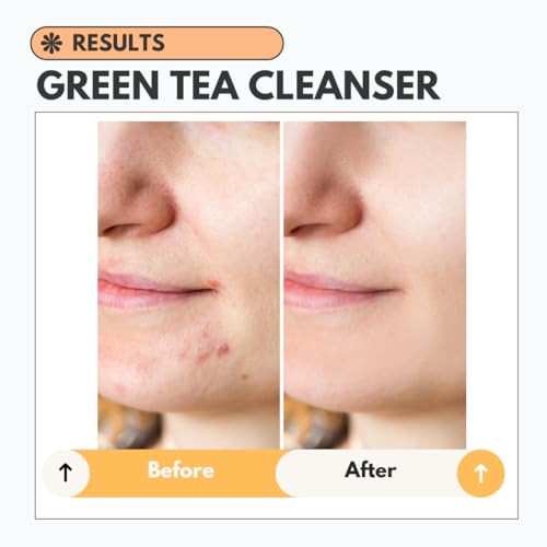 Clarifying Green Tea Hyaluronic Acid Serum for red light therapy with Niacinamide - Skin Repairing and Clarifying Face Serum