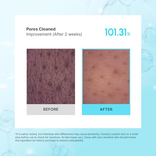 Tea Tree Facial Cleanser Foam for Oily & Sensitive Skin - 150ml