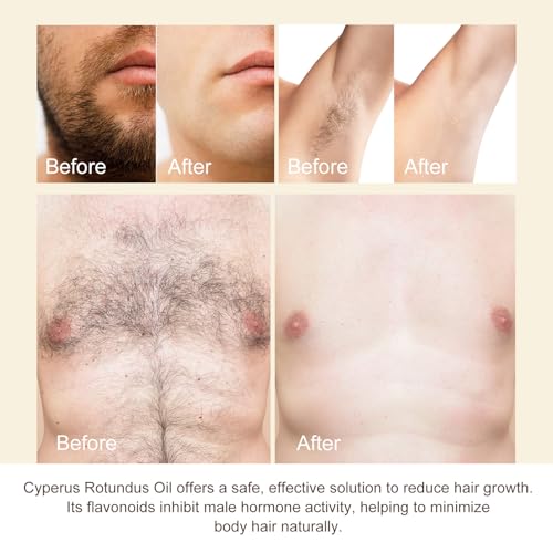 Cyperus Rotundus Oil for Hair Removal - 100% Pure Essential Oil, 60ml