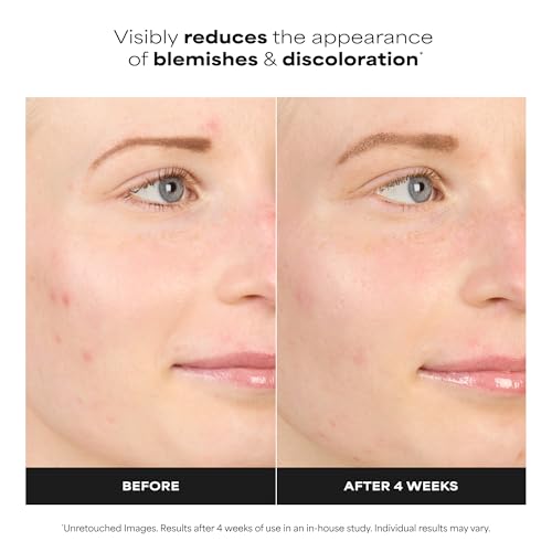 Paula's Choice 10% Azelaic Acid Serum - Acne & Spot Treatment