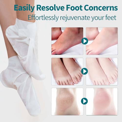 5 Pack Moisturizing Foot Mask Socks for Dry Cracked Feet
