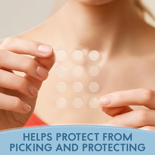 Zovira Invisible Daytime Acne Pimple Patch 36 Count, Niacinamide, Salicylic Acid, Tea Tree and Neem Oil, Suitable for Sensitive Skin, Tapered Edges Blend into All Skin Tones, Reduce Redness