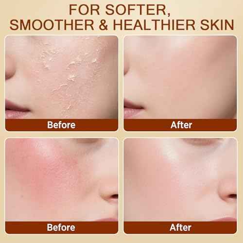 Tallow and Honey Balm for Face, Beef Tallow for Skin, Grass-Fed Beef Tallow & Raw Wild Honey, Body & Face Moisturizer