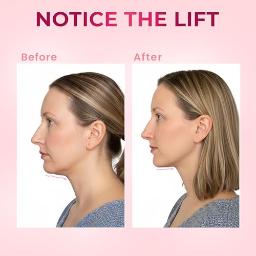 V-Line Chin Up Mask – Double Chin Reducer & Jawline Shaper