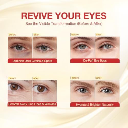 GONIM Under Eye Patches 360¡Æ Fit, Eye Mask with Collagen Peptide, Salmon DNA PDRN, Retinol, Caffeine & Niacinamide, Eye Patches for Puffy Eyes and Dark Circles, Gifts for Women, Travel 4 pairs x 2