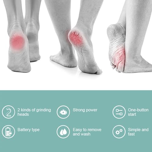 Electric Callus Remover with Vacuum - Portable Foot Grinder