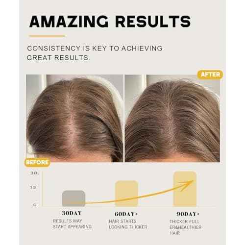 Batana Oil for Hair Growth, 100% Natural Pure Batana Oil Paste from Dr. Sebi Honduras, Prevents Hair Loss, Enhances Thickness, Organic Raw Batana Hair Mask for Women & Men (4.05 Oz)