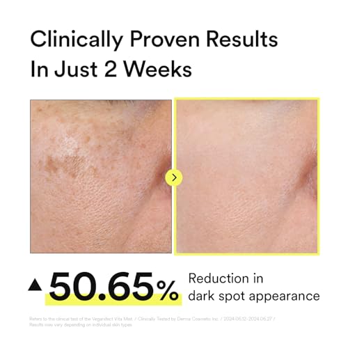 Vitamin C Glow Mist for Radiant Skin, Hydrating Serum Mist with Niacinamide & Glutathione, Korean Vegan Skincare, 3.38 Fl Oz