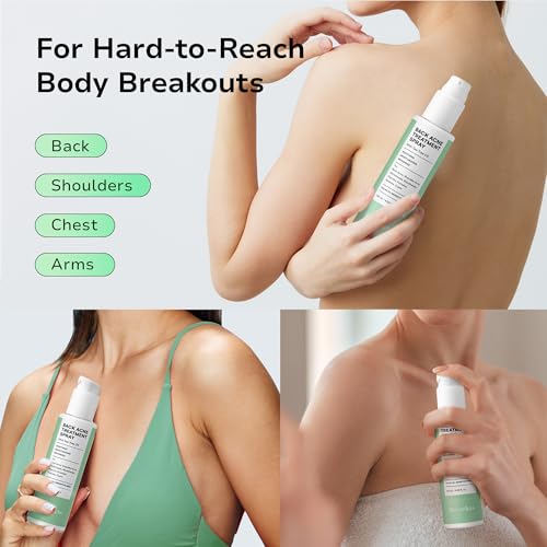 BellamiLuxx Back Acne Spray with 2% Salicylic Acid