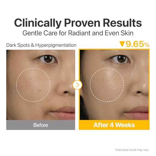 numbuzin No.5 Serum 30ml | Tranexamic Acid 4%, Niacinamide 5%, Glutathione, Vitamin C |Vitamin Concentrated Serum | Hyperpigmentation| Suitable for Sensitive Skin, Korean Skincare | 1.01 fl. oz.