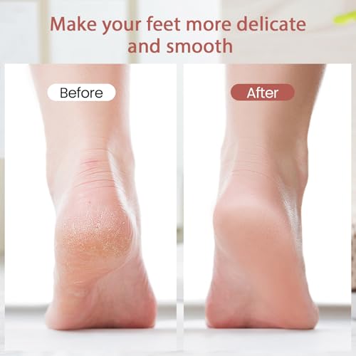 ZABOUL Electric Foot Callus Remover with 2 Roller Heads