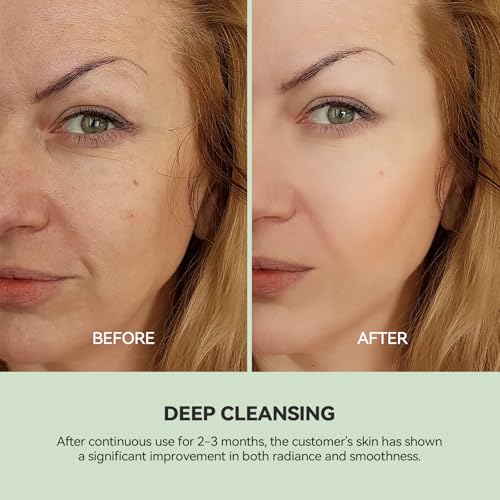 WNP Duo Cleansing Clay Mask with Niacinamide & Hyaluronic Acid ? Deep Pore Cleanser for T-Zone & U-Zone, Blackhead Remover, Hydrating & Oil-Control Face Mask, 3.53oz (Pack of 2)
