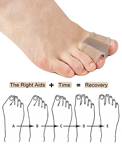 Golbylicc Gel Bunion Corrector & Toe Separators with 2 Loops (2 Pack)
