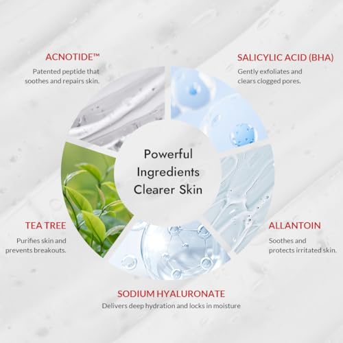 MIZON GoodByeBlemish Soothing Gel Cream with Acnotide, for Sensitive Skin, Breakout Treatment, Acne Spot Treatment (55ml 1.85 fl oz)
