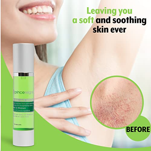 Ingrown Hair Serum - Organic Razor Bump & Redness Solution for Men & Women, Ideal for Face, Bikini, Legs, Underarm, Prevents Future Ingrown Hairs, No Alcohol or Oils - 2 Fl. Oz