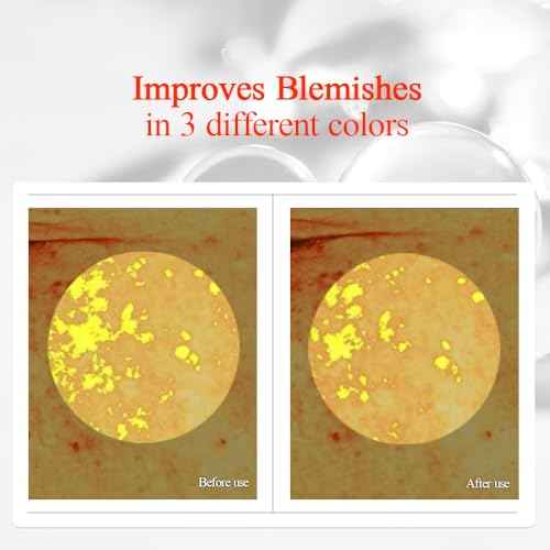 Pyunkang Yul PKY Radiance Vita Toner for Flawless and Radiant Skin, Blemish Care Toner with Vitamin C & Niacinamide, Zero Irritation, Korean Skincare (5.07 Fl. Oz, 150ml)